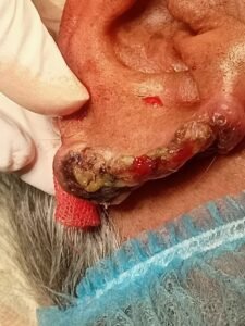 LIvekhabhar | Chhattisgarh News